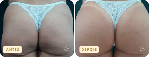 transform-6.webp